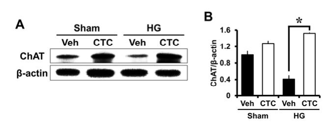 糖尿病病人发生低血糖时能吃糖吗,磷酸胞磷胆碱治疗糖尿病并发症