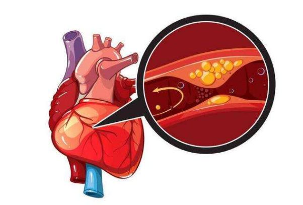 当你有“1多、2快、3痛”的表现时要注意了