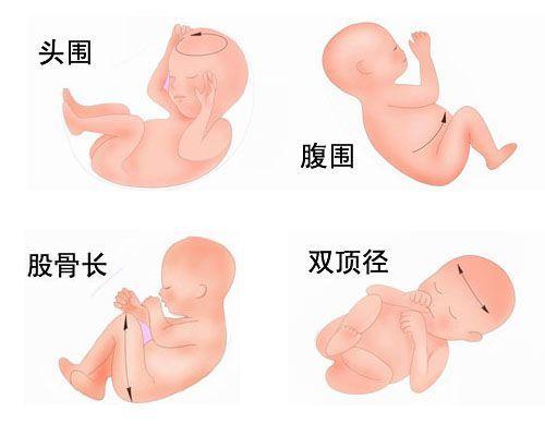 孕早期b超如何计算天数,早期b超根据哪里算孕周