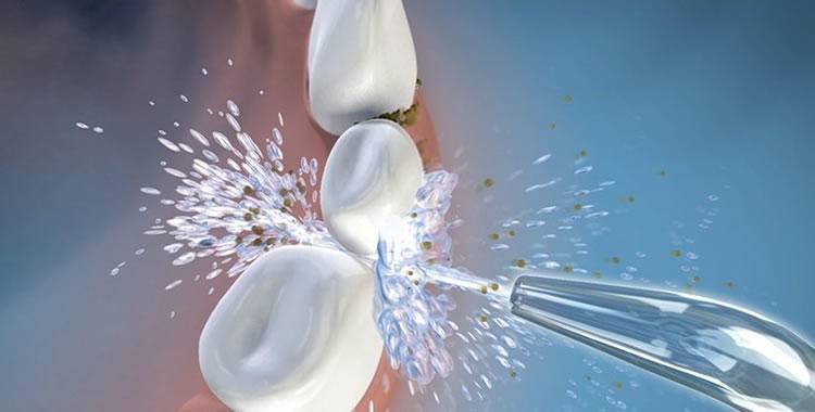 春季唇妆,唇妆不好看