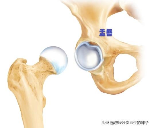 髋关节疼痛会引起腿痛吗,髋关节疼痛两腿不一样长如何康复