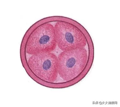 胚胎移植成功后有哪些注意事项,胚胎移植后的常见症状是什么