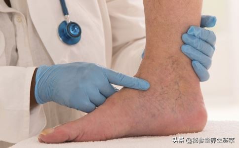 脚痛可能是8种疾病的征兆右脚,脚痛的人有哪些症状