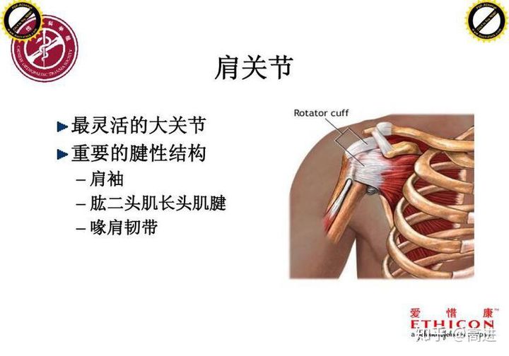 肩袖损伤最简单的恢复方法,肩袖损伤恢复的正确方法