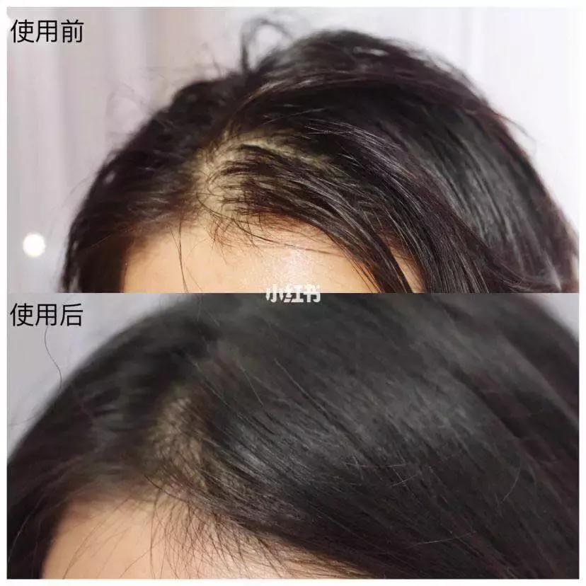 女生一定要知道的变美小技巧,长相普通的女生如何快速变美