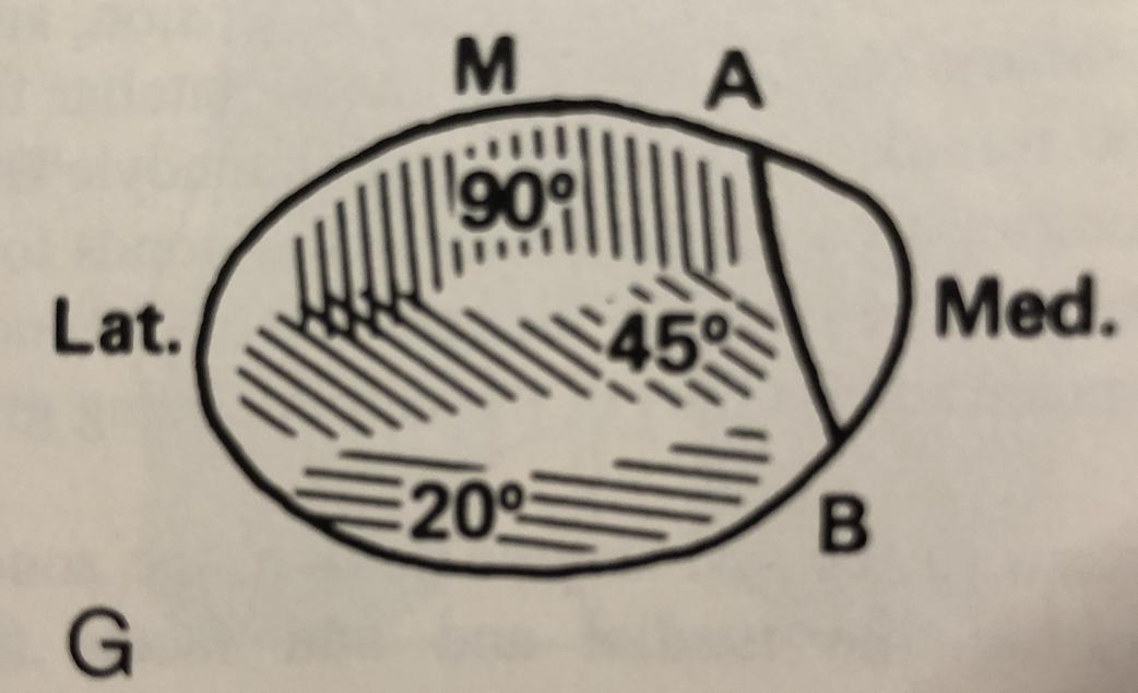 膝盖附近疼是髌骨软化症引起的吗,髌骨膝前疼痛综合症