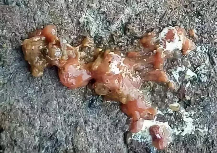 “五颜六色”的粪便背后隐藏着什么？又和肝脏疾病有怎样的联系呢