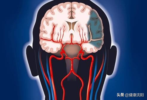 健康科普堂,卒中健康大讲堂