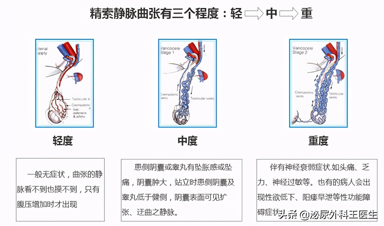 精子质量太差怎么能提高精子质量,人的精子干净程度