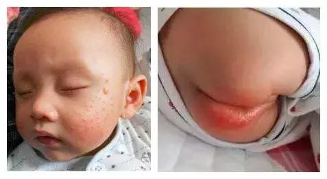 一周大婴儿皮肤护理产品,宝宝皮肤护理法宝