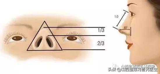 隆鼻的真实感受男生,男生隆鼻和女生的区别