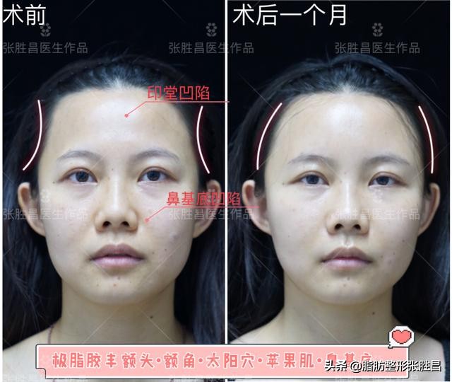 快速有效暴瘦腰腹练出马甲线,紧致身材零赘肉这样健身才最有效