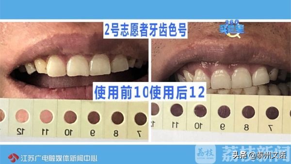 超强美白牙贴,网红美白牙笔有没有用