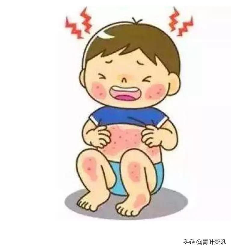 冬季，如何摆脱恼人的冻疮？