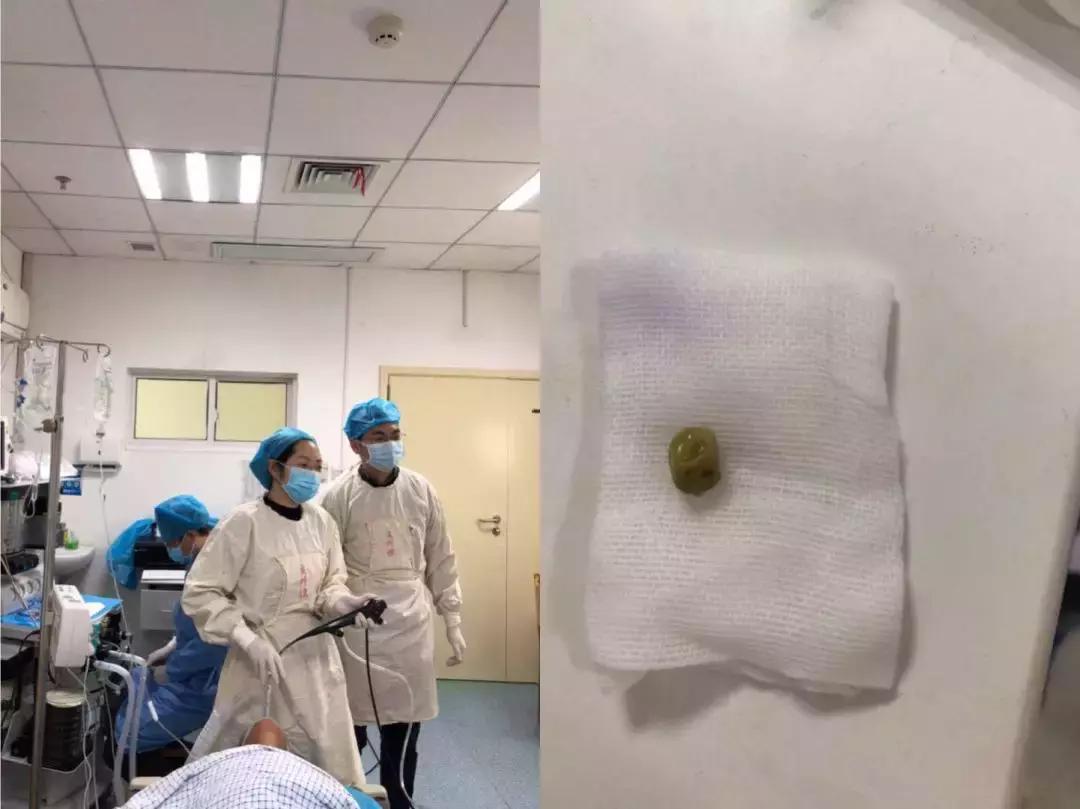 如何预防误吸,误吸急救流程详解