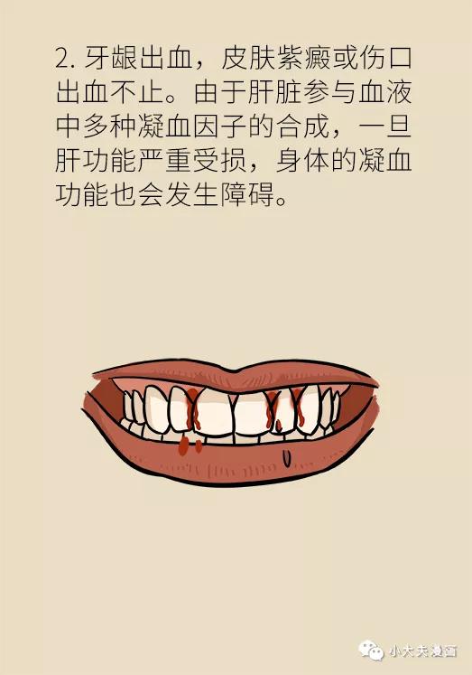 经常洗牙为什么也有牙菌斑,一洗牙牙龈出血是咋回事