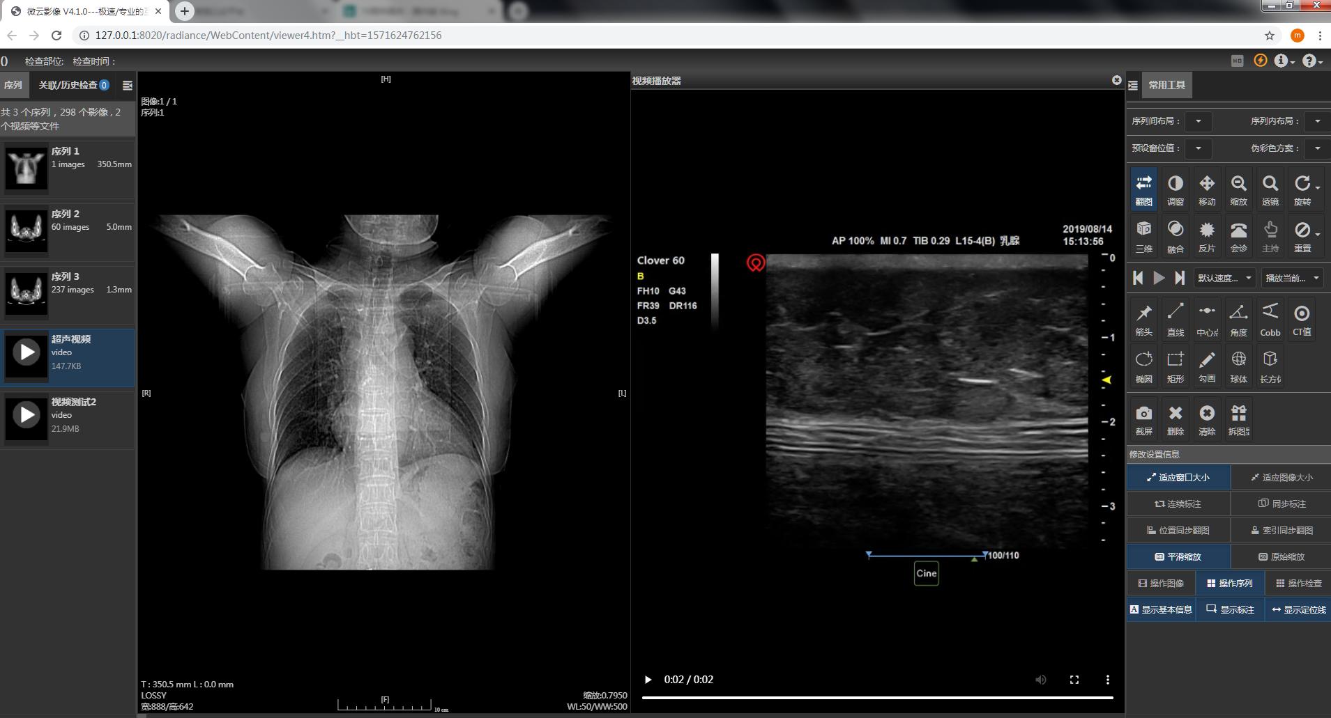 鍖诲褰卞儚鍣ㄦ潗灞曠ず瑙嗛,瓒呮竻鍖诲褰卞儚