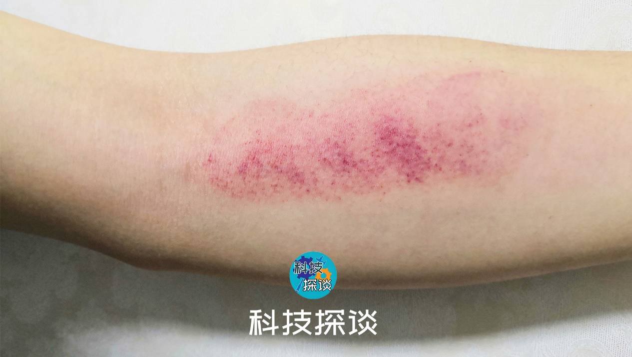 宾多康智能颈椎按摩仪,宾多康智能无烟艾灸仪