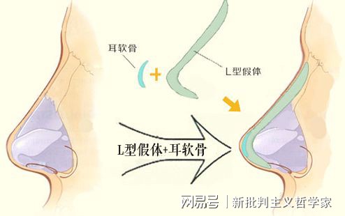 名医专访丨上海交通大学医学院附属同仁医院许瑾：面部美容整形