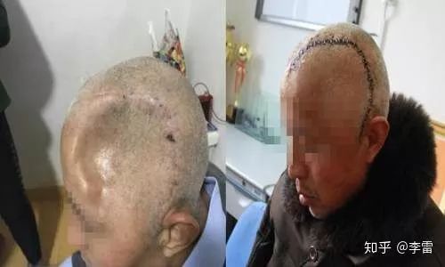 劳荣枝相貌变化这么大,劳荣枝逃亡20年是谁认出了她