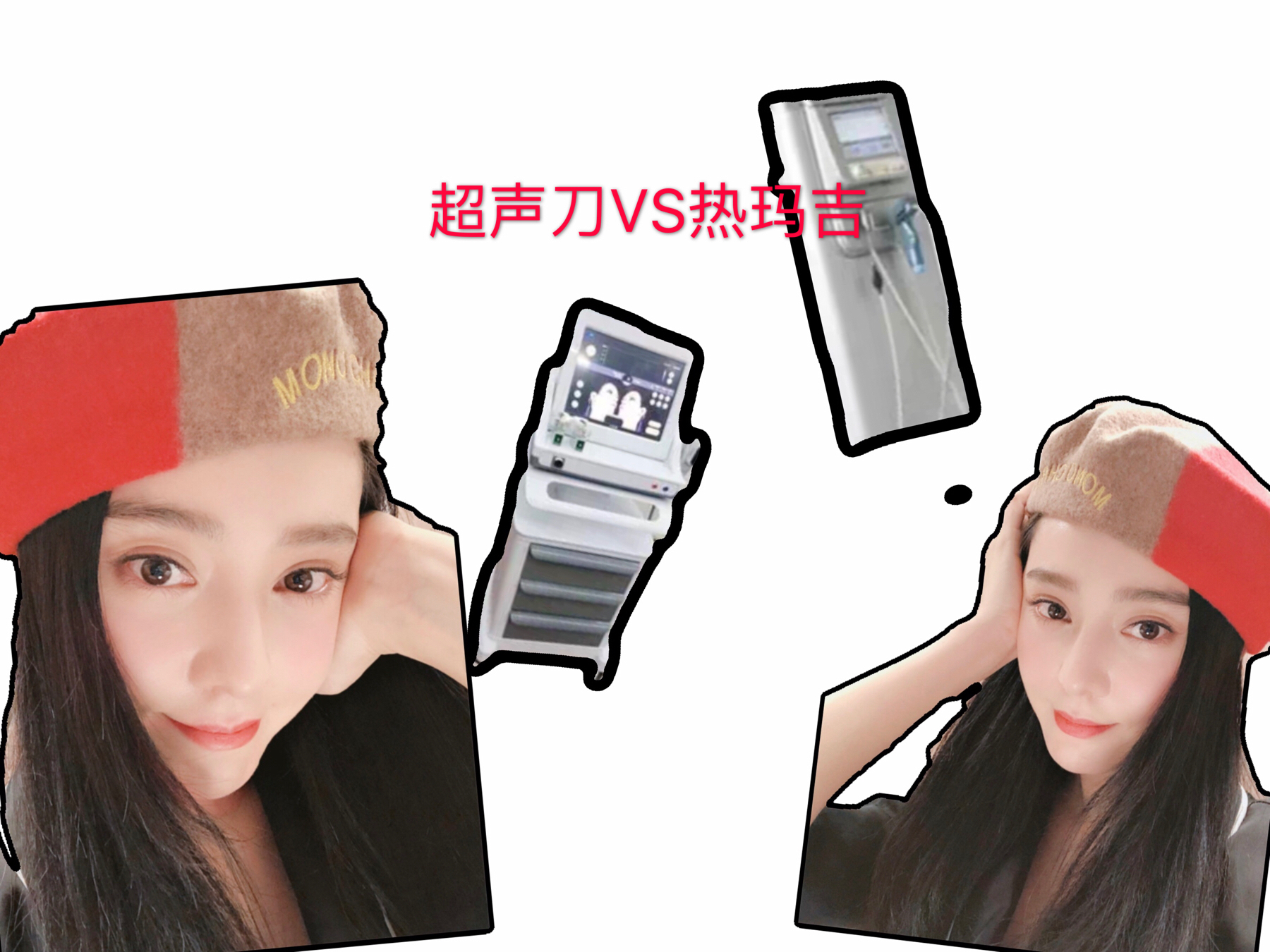 超声刀热玛吉都是什么仪器,医美小课堂热玛吉和超声刀区别