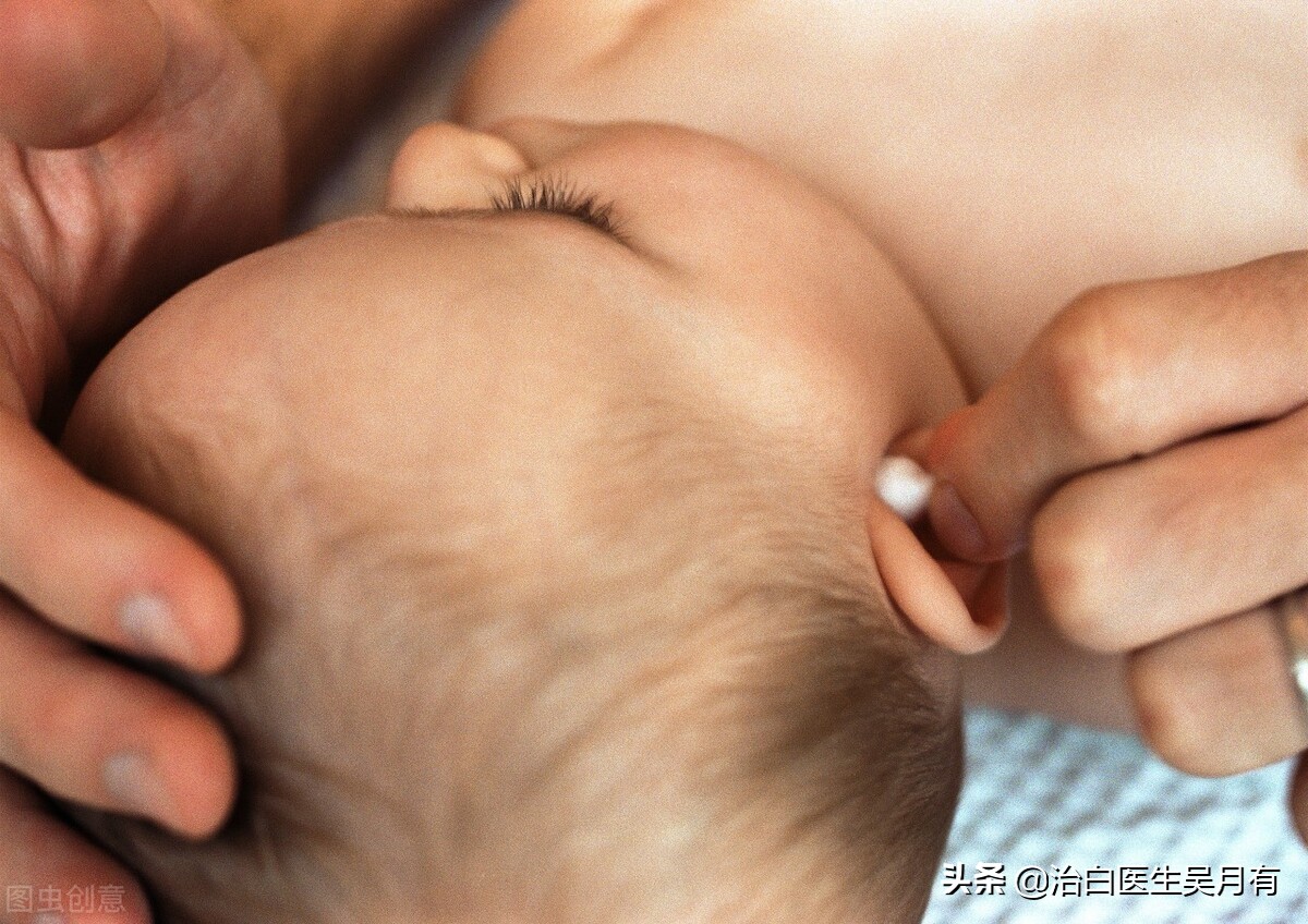 四个月宝宝手臂患有白癜风如何治疗?