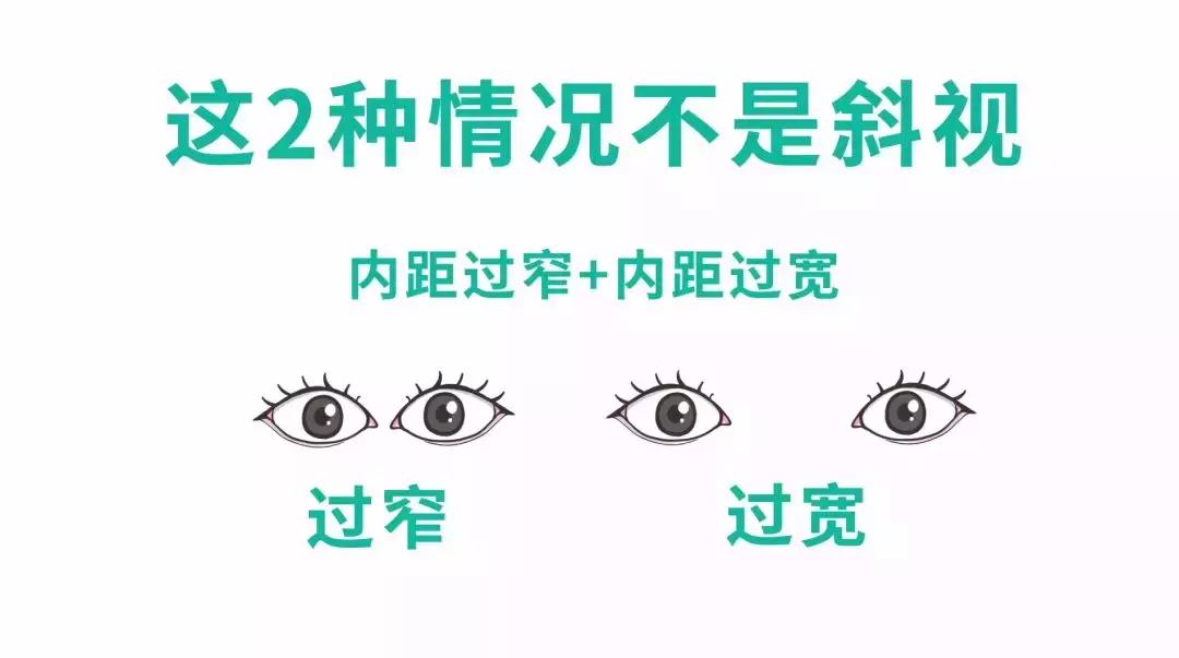 3秒辨别孩子是不是斗鸡眼,怎么判断小孩斗鸡眼