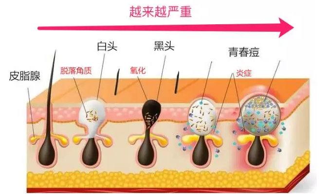 如何解决校园霸凌问题,如何解决水烧开有白色沉淀物