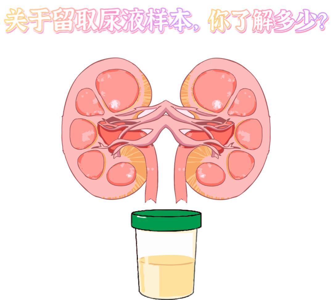 做尿检,不得不说的注意事项