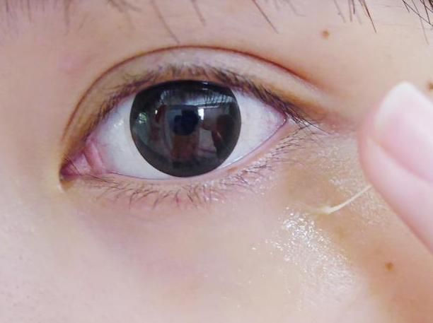 眼霜排行榜10强平价祛细纹脂肪粒,推荐一款18岁以下平价熬夜眼霜吧