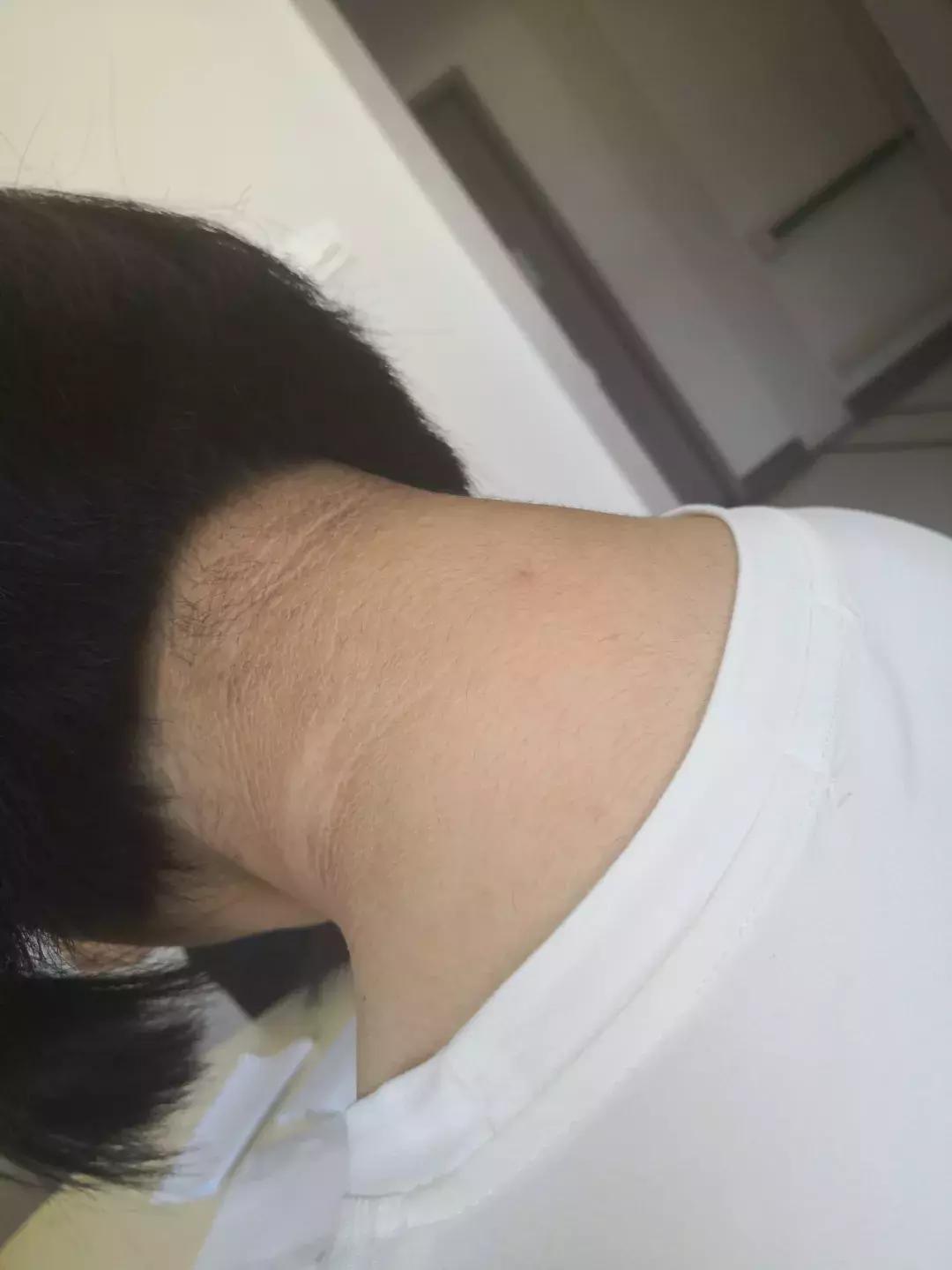 萝莉少女大长腿,为何腿毛长又黑?