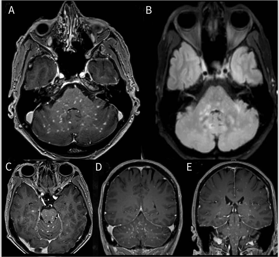 一文读懂13种最常见癌症筛查攻略,一文读懂5大慢性炎症检测项目