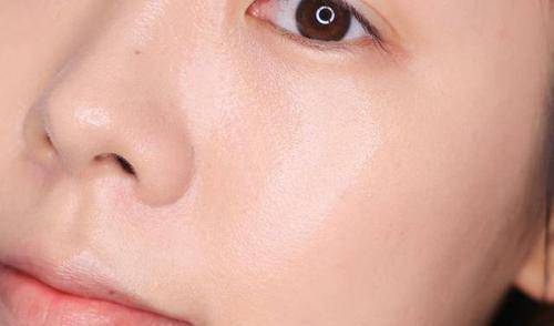 混合性肌肤t区出油怎么办,混合皮肤t区出油是什么原因