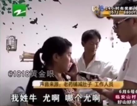 1818黄金眼杭州姑娘整容,1818黄金眼整容成功案例