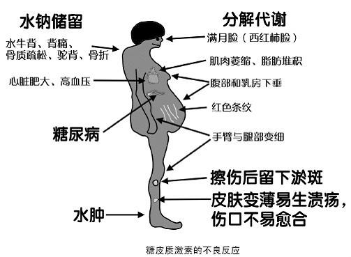 大头娃娃激素,激素大头娃娃