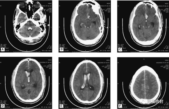 值夜班需要注意什么身体健康,值夜班的十大危害