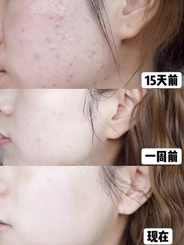 姘ㄥ熀閰稿噣閫忕編鐧芥磥闈钩鐩存挱,姘ㄥ熀閰告场娌礂闈㈠ザ缇庣櫧鐩存挱