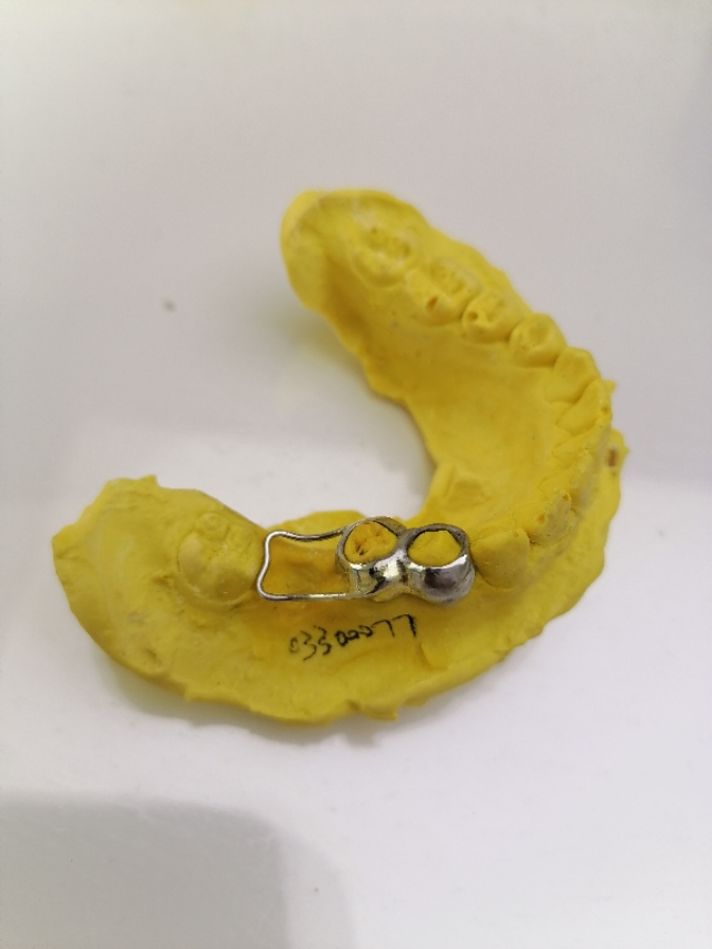 未成年人牙齿缺失怎么办,未成年人牙齿烂到不能补了怎么办