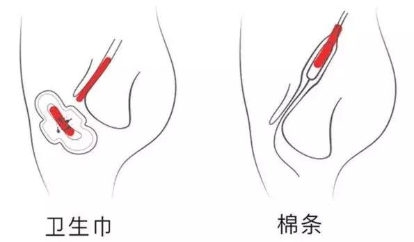 记住这5点选对姨妈巾,医生科普选错姨妈巾的危害