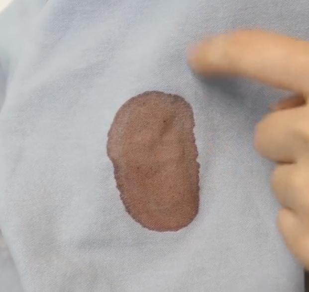 如何去除床单上顽固血渍,床单上的新鲜血渍怎样快速清除