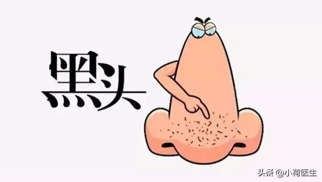 黑头怎么祛除最快最有效的方法,激光祛黑头可以让黑头变少吗