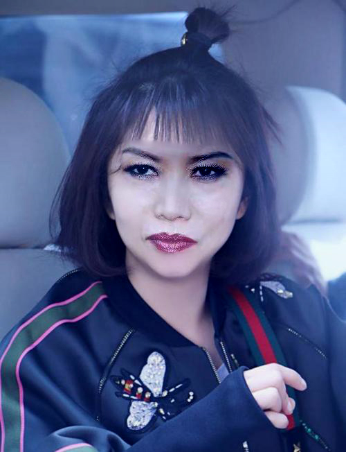 瘦脸针面部提升填充前后对比,面部打脂肪针有什么风险