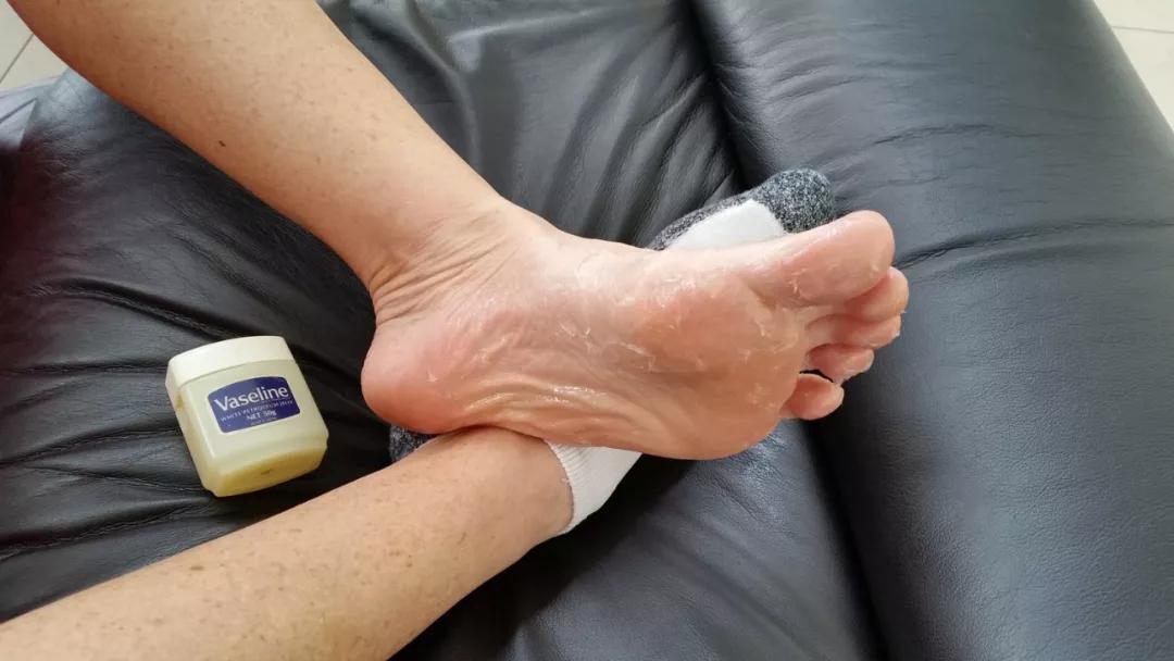 新买的足球鞋磨脚后跟有什么妙招,如何让足球鞋不磨脚