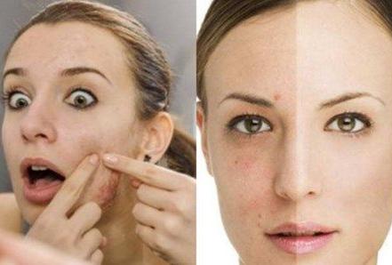 皮肤出油耳朵外也出油怎么回事,皮肤出油导致的脸部蜡黄