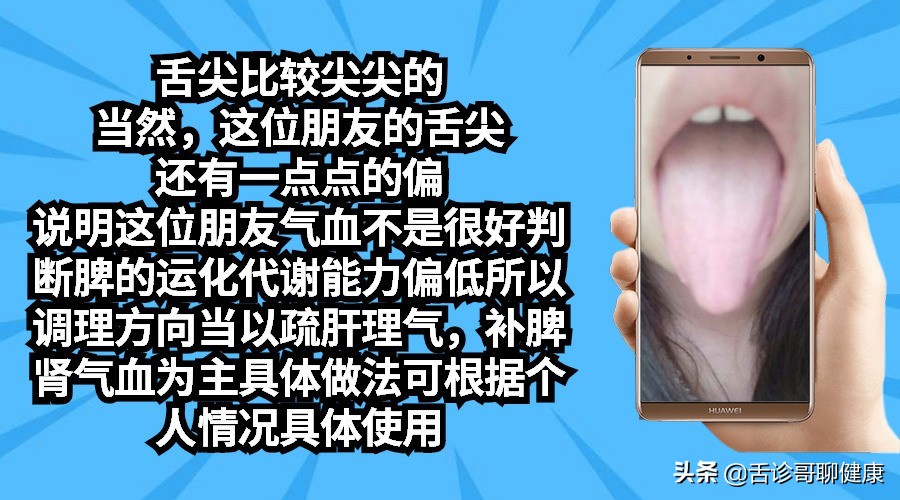 舌诊哥:遗精滑精、气短、虚汗、紧张、焦虑等舌象分析