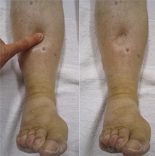 中医路志正治什么病,国医大师路志正秘方