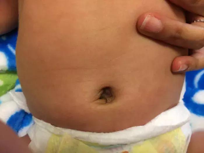 手指皮肤发黑是什么原因,手指关节处皮肤发黑发皱