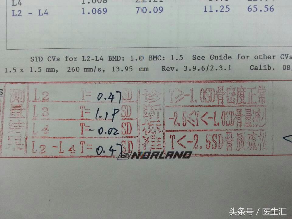 2型糖尿病自愈的真实例子,2型糖尿病病例