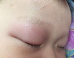 孕期注意什么防止宝宝将来过敏,孕期不注意婴儿容易得什么病