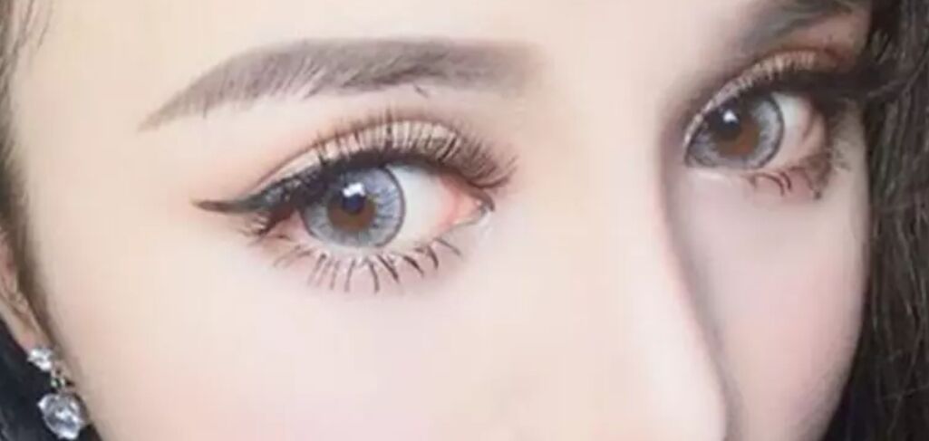 摘下眼镜就感觉双目无神,担心眼睛失明